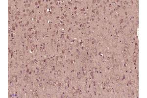 Paraformaldehyde-fixed, paraffin embedded rat brain, Antigen retrieval by boiling in sodium citrate buffer (pH6) for 15min, Block endogenous peroxidase by 3% hydrogen peroxide for 30 minutes, Blocking buffer (normal goat serum) at 37°C for 20min, Antibody incubation with RPS6KA1(Thr348) Polyclonal Antibody  at 1:400 overnight at 4°C, followed by a conjugated secondary and DAB staining. (RPS6KA1 antibody  (pThr348))