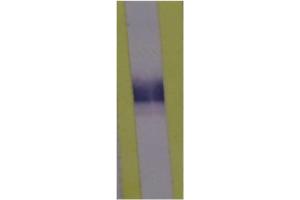 Western Blotting (WB) image for anti-Lipopolysaccharide Binding Protein (LBP) antibody (ABIN343173) (LBP antibody)