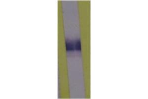 Western Blotting (WB) image for anti-Lipopolysaccharide Binding Protein (LBP) antibody (ABIN343173)