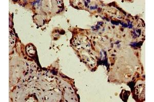 Immunohistochemistry of paraffin-embedded human placenta tissue using ABIN7146610 at dilution of 1:100 (PKIB antibody  (AA 1-77))