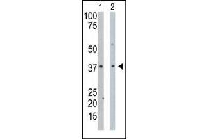 The anti-PDXK Pab is used in Western blot to detect PDXK in mouse intestine tissue lysate (Lane 1) and Hela cell lysate (Lane 2).