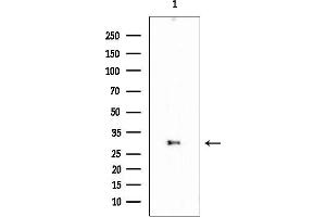 anti-Sodium Channel Modifier 1 (SCNM1) (Internal Region) antibody