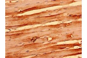 Immunohistochemistry analysis of human skeletal muscle tissue using ABIN7161366 at dilution of 1:100 (NEGR1 antibody  (AA 1-196))