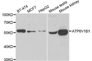 Western blot analysis of extracts of various cell lines, using ATP6V1B1 antibody (ABIN5975742) at 1/1000 dilution. (ATP6V1B1 antibody)