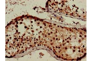 Immunohistochemistry of paraffin-embedded human testis tissue using ABIN7166795 at dilution of 1:100 (SLITRK2 antibody  (AA 79-111))