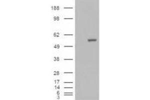 Image no. 2 for anti-Aldehyde Dehydrogenase 1 Family, Member A1 (ALDH1A1) (C-Term) antibody (ABIN374078) (ALDH1A1 antibody  (C-Term))