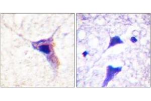 Immunohistochemistry analysis of paraffin-embedded human brain, using Synapsin1 (Phospho-Ser62) Antibody. (SYN1 antibody  (pSer62))