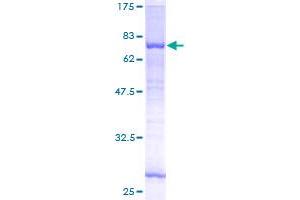 Image no. 1 for Mannosyl (Alpha-1,6-)-Glycoprotein beta-1,2-N-Acetylglucosaminyltransferase (MGAT2) (AA 1-447) protein (GST tag) (ABIN1310822) (MGAT2 Protein (AA 1-447) (GST tag))