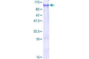 Image no. 1 for PDX1 C-terminal Inhibiting Factor 1 (PCIF1) (AA 1-704) protein (GST tag) (ABIN1314314) (PCIF1 Protein (AA 1-704) (GST tag))