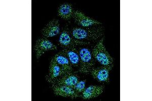 Confocal immunofluorescent analysis of Phospho-ABL1- Antibody (ABIN389502 and ABIN2839560) with MCF-7 cell followed by Alexa Fluor 488-conjugated goat anti-rabbit lgG (green). (ABL1 antibody  (pTyr245))
