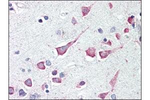 Image no. 1 for anti-Death-Associated Protein Kinase 3 (DAPK3) (Center) antibody (ABIN303252) (DAPK3 antibody  (Center))