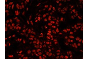 Immunofluorescence (IF) image for anti-5'-3' Exoribonuclease 2 (XRN2) (AA 900-950) antibody (ABIN7449038)
