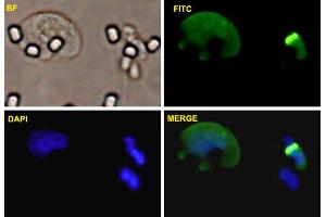 Immunofluorescence (IF) image for anti-Zinc Finger E-Box Binding Homeobox 1 (ZEB1) (AA 801-900) antibody (ABIN520780)