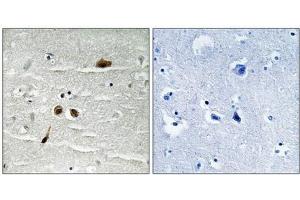 Immunohistochemical analysis of paraffin-embedded human brain tissue using MDC1 (Phospho-Ser513) antibody (left)or the same antibody preincubated with blocking peptide (right).