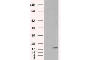 Image no. 2 for anti-Ribosomal Protein S19 (RPS19) (Internal Region) antibody (ABIN374632) (RPS19 antibody  (Internal Region))
