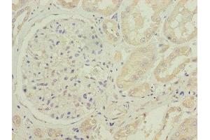 Immunohistochemistry of paraffin-embedded human kidney tissue using ABIN7149122 at dilution of 1:100 (CYB5B antibody  (AA 2-118))
