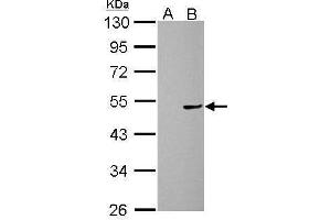 WB Image Cannabinoid Receptor 1 antibody [C1C2], Internal detects CNR1 protein by Western blot analysis. (CNR1 antibody  (C-Term))