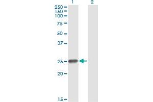 Western Blot analysis of RNF114 expression in transfected 293T cell line by ZNF313 monoclonal antibody (M03), clone S2. (RNF114 antibody  (AA 1-228))