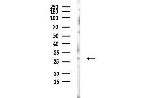 anti-SUMO/sentrin Specific Peptidase Family Member 8 (SENP8) (C-Term) antibody