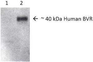 Western blot analysis of Human, Rat Brain cell lysates showing detection of BVR protein using Rabbit Anti-BVR Polyclonal Antibody . (Biliverdin Reductase antibody  (HRP))