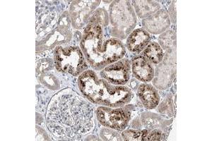 Immunohistochemical staining of human kidney with CEP85L polyclonal antibody  shows strong cytoplasmic positivity in cells of tubules at 1:10-1:20 dilution.