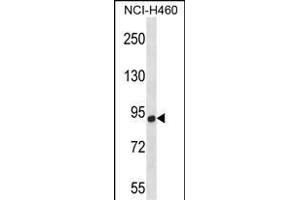 CHSY1 Antibody (Center) (ABIN657509 and ABIN2846533) western blot analysis in NCI- cell line lysates (35 μg/lane).