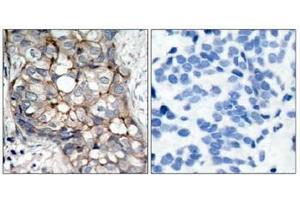 Image no. 3 for anti-Epidermal Growth Factor Receptor (EGFR) (AA 1068-1072) antibody (ABIN197228) (EGFR antibody  (AA 1068-1072))