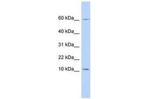 Image no. 1 for anti-Peptidase Inhibitor 3, Skin-Derived (PI3) (N-Term) antibody (ABIN6743360)