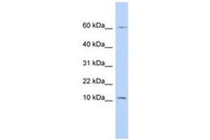 Image no. 1 for anti-Peptidase Inhibitor 3, Skin-Derived (PI3) (N-Term) antibody (ABIN6743360) (PI3 antibody  (N-Term))