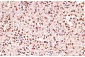 Immunohistochemistry of paraffin-embedded Mouse kidney using Phospho-ATF2(T71) Polyclonal Antibody at dilution of 1:100 (40x lens). (ATF2 antibody  (pThr71))