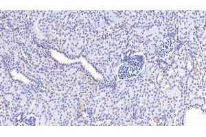 Detection of GCDH in Human Kidney Tissue using Polyclonal Antibody to Glutaryl Coenzyme A Dehydrogenase (GCDH) (GCDH antibody  (AA 270-438))