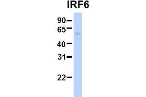 Host:  Rabbit  Target Name:  SERPINA3  Sample Type:  Human Adult Placenta  Antibody Dilution:  1. (IRF6 antibody  (Middle Region))