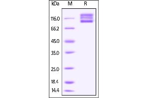 Human ITGAV & ITGB8 Heterodimer Protein on SDS-PAGE under reducing (R) condition.