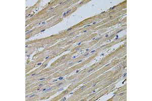 Immunohistochemistry of paraffin-embedded rat heart using EIF4A2 antibody (ABIN2736687) at dilution of 1:100 (40x lens). (EIF4A2 antibody)