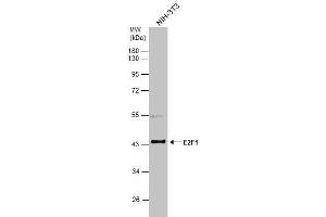 WB Image Whole cell extract (30 μg) was separated by 10% SDS-PAGE, and the membrane was blotted with E2F1 antibody , diluted at 1:3000. (E2F1 antibody)