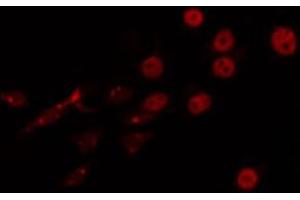 ABIN6266747 staining LOVO by IF/ICC. (FOXJ1 antibody  (Internal Region))