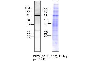 ELP3/KAT9 Protein (AA 1-547) (Strep Tag)