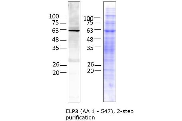 ELP3/KAT9 Protein (AA 1-547) (Strep Tag)
