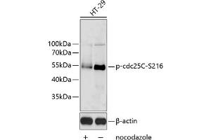 Western blot analysis of extracts of HT-29 cells, using Phospho-cdc25C-S216 antibody (ABIN6135198, ABIN6136038, ABIN6136039 and ABIN6225599). (CDC25C antibody  (pSer216))