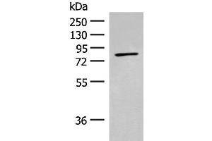 Western blot analysis of Mouse kidney tissue lysate using ADAM21 Polyclonal Antibody at dilution of 1:200 (ADAM21 antibody)