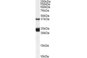 Image no. 1 for anti-Galanin Receptor 1 (GALR1) (Internal Region) antibody (ABIN374858)
