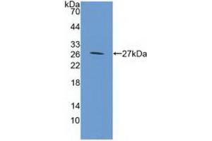 Western blot analysis of recombinant Mouse GP39. (CHI3L1 antibody  (AA 112-356))
