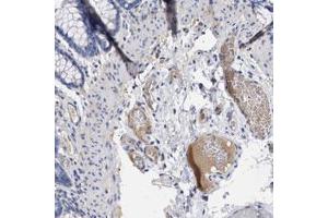 Immunohistochemical staining (Formalin-fixed paraffin-embedded sections) of human colon with PLG polyclonal antibody  shows positivity in plasma. (PLG antibody)