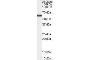 ABIN334367 (0. (CACNB4 antibody  (Internal Region))