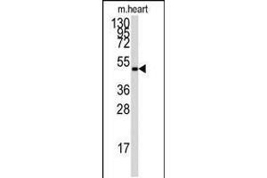 Antibody is used in Western blot to detect PRKAG1 in mouse heart tissue lysate. (PRKAG3 antibody  (AA 265-295))