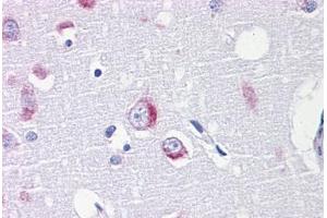 anti-Aspartyl-tRNA Synthetase (DARS) (AA 393-501) antibody