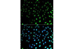 Immunofluorescence analysis of MCF7 cell using S100A8 antibody. (S100A8 antibody  (AA 1-93))