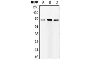 Western blot analysis of ALS expression in HEK293T (A), mouse liver (B), rat kidney (C) whole cell lysates. (SOD1 antibody  (Center))