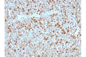 Formalin-fixed, paraffin-embedded human Tonsil stained with Alpha-1-Antitrypsin Mouse Monoclonal Antibody (AAT/1379). (SERPINA1 antibody)