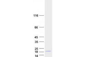 CGRP Receptor Component (CRCP) (Transcript Variant 2) protein (Myc-DYKDDDDK Tag)